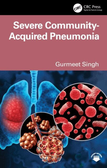 Gurmeet Singh - Severe Community-Acquired Pneumonia, E-bok
