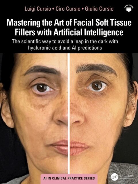 Giulia Cursio, Ciro Cursio, Luigi Cursio - Mastering the Art of Facial Soft Tissue Fillers with Artificial Intelligence, E-bok