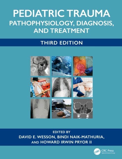 Howard Irwin Pryor II, Bindi Naik-Mathuria, David E. Wesson - Pediatric Trauma, E-bok