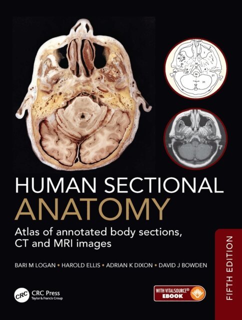 David J Bowden, Adrian K Dixon, Harold Ellis, Bari M Logan - Human Sectional Anatomy, E-bok