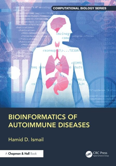 Hamid D. Ismail - Bioinformatics of Autoimmune Diseases, E-bok