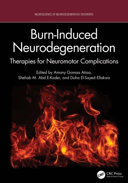 Doha El-Sayed Ellakwa, Shehab M. Abd E-Kader, Amany Gomaa Atiaa - Burn-Induced Neurodegeneration, E-bok