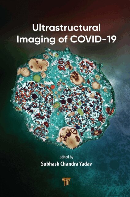Subhash Chandra Yadav - Ultrastructural Imaging of COVID-19, E-bok