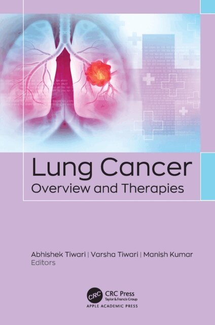 Manish Kumar, Varsha Tiwari, Abhishek Tiwari - Lung Cancer, E-bok