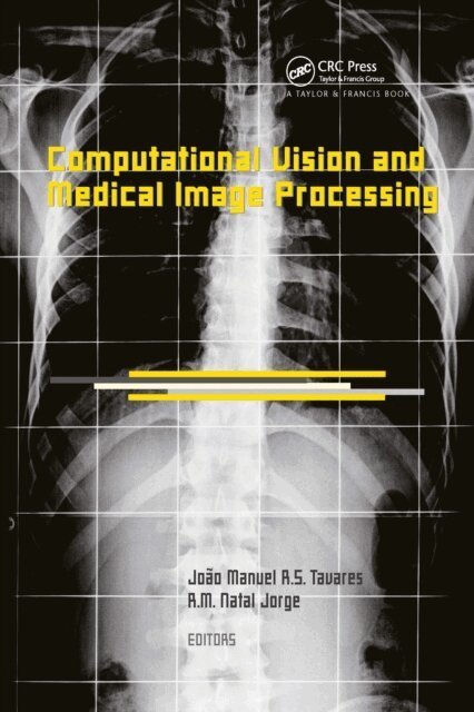 R.M. Natal Jorge, Joao Manuel R.S. Tavares - Computational Vision and Medical Image Processing, E-bok
