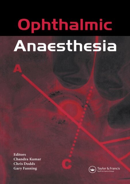 C. Kumar, G. Fanning, C. Dodds - Ophthalmic Anaesthesia, E-bok
