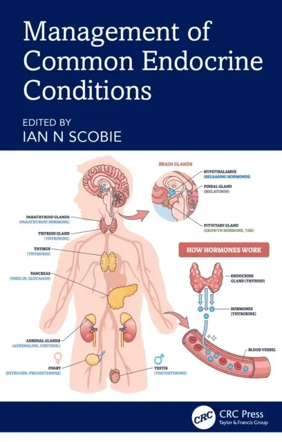 Ian N Scobie - Management of Common Endocrine Conditions, E-bok. Tillgänglighet: Lägg i varukorg