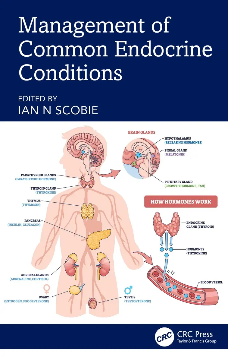 Ian N Scobie - Management of Common Endocrine Conditions, Häftad. Tillgänglighet: Lägg i varukorg