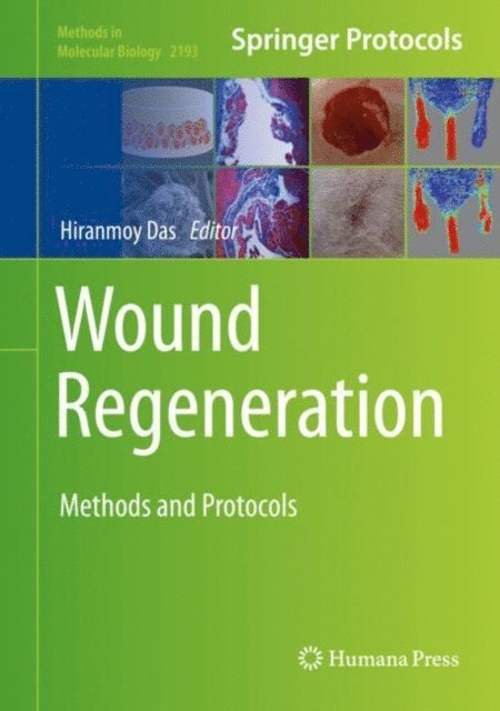 Hiranmoy Das - Wound Regeneration, E-bok