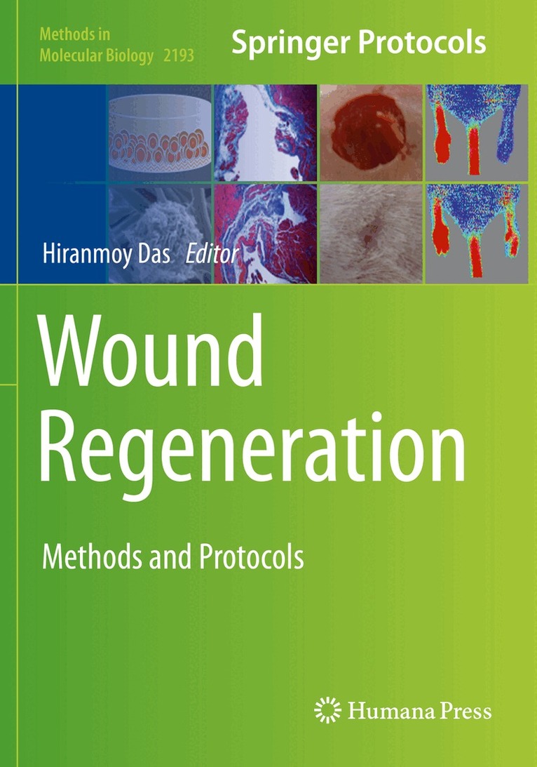 Hiranmoy Das - Wound Regeneration, Häftad