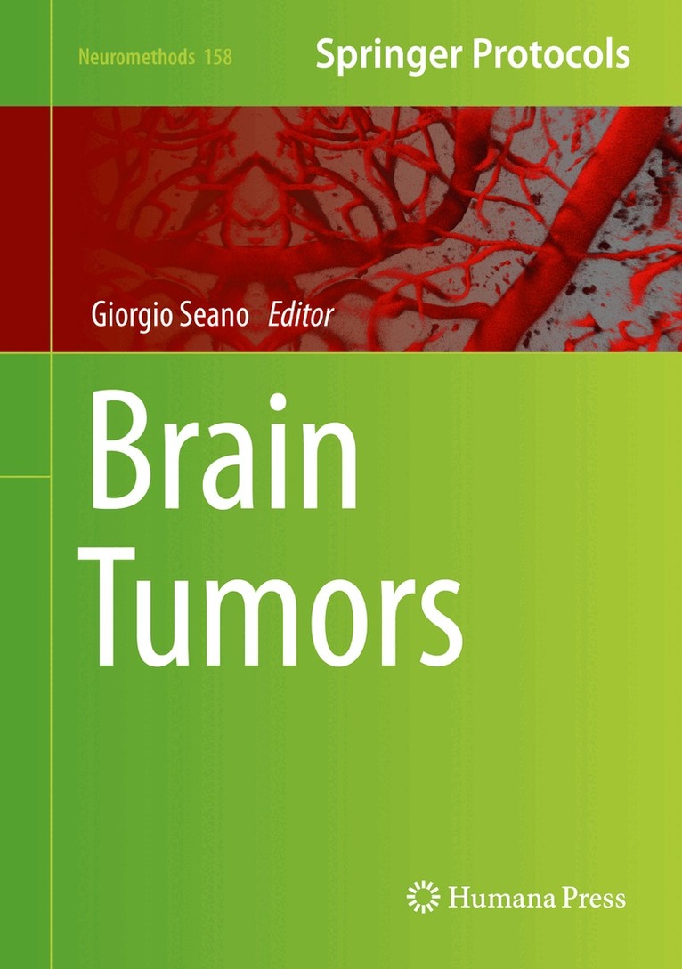 Giorgio Seano - Brain Tumors, Inbunden