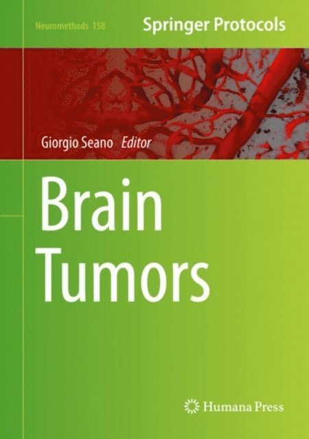 Giorgio Seano - Brain Tumors, E-bok