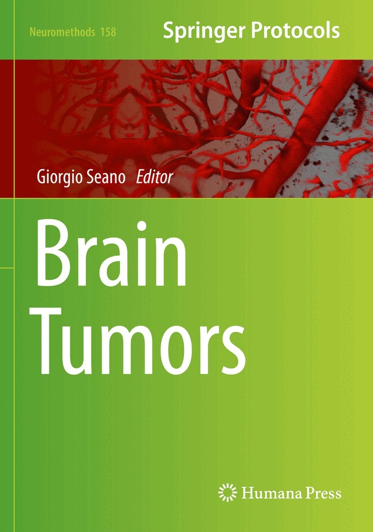 Giorgio Seano - Brain Tumors, Häftad