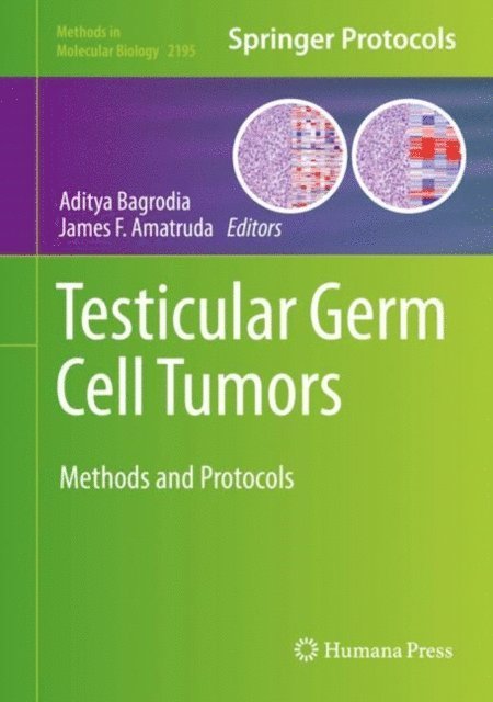 James F. Amatruda, Aditya Bagrodia - Testicular Germ Cell Tumors, E-bok