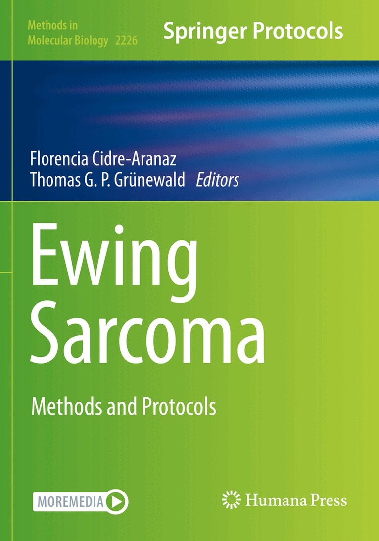 Florencia Cidre-Aranaz, Thomas G. P. Grünewald - Ewing Sarcoma, Häftad. Tillgänglighet: Lägg i varukorg