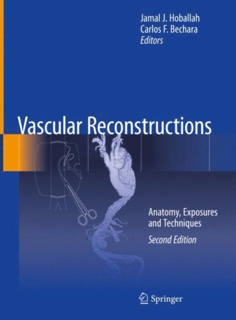 Carlos F. Bechara, Jamal J. Hoballah - Vascular Reconstructions, E-bok