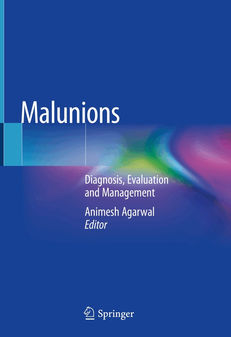 Animesh Agarwal - Malunions, Inbunden