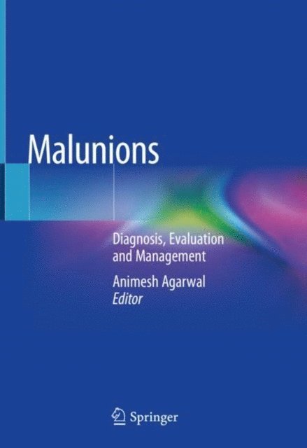 Animesh Agarwal - Malunions, E-bok