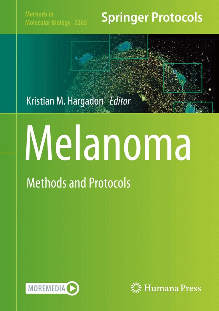Kristian M. Hargadon - Melanoma, Inbunden