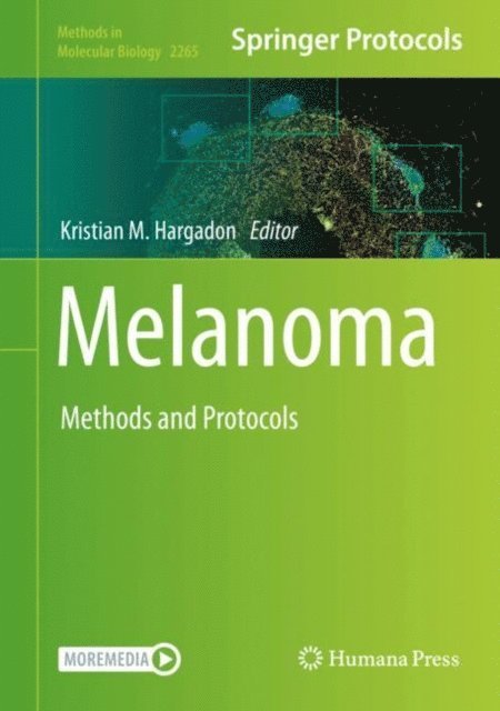 Kristian M. Hargadon - Melanoma, E-bok