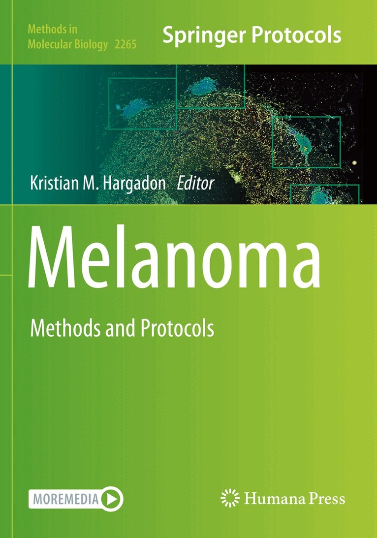 Kristian M. Hargadon - Melanoma, Häftad