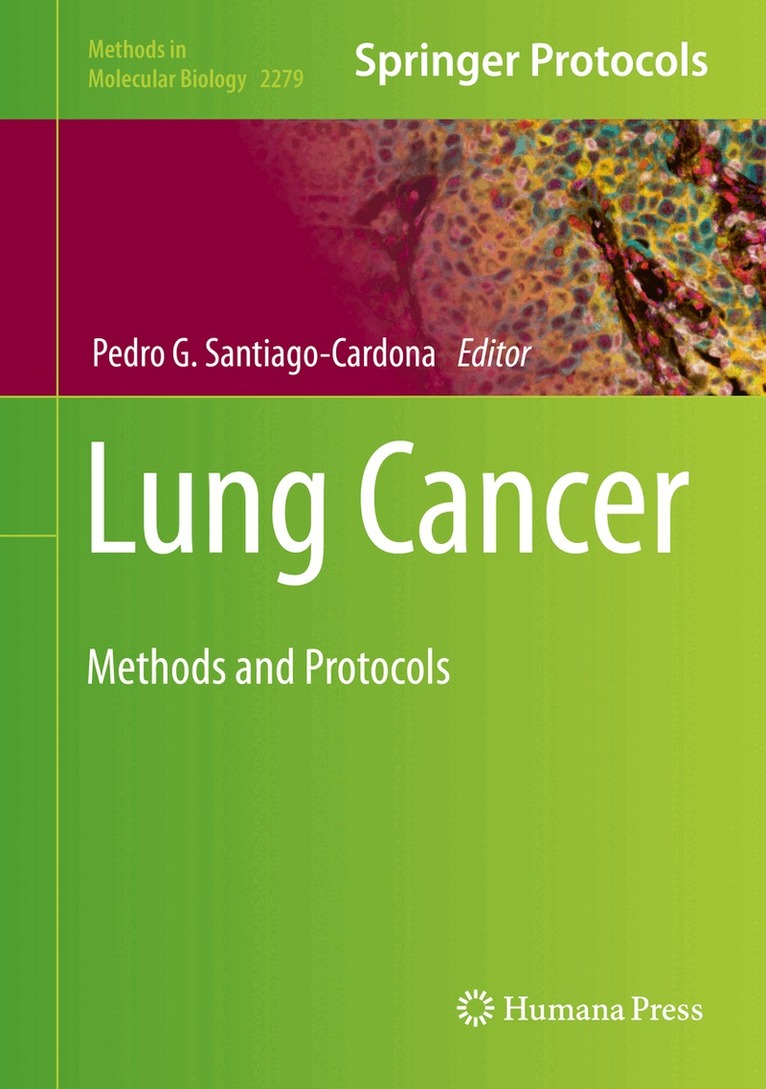 Pedro G. Santiago-Cardona - Lung Cancer, Inbunden. Tillgänglighet: Lägg i varukorg