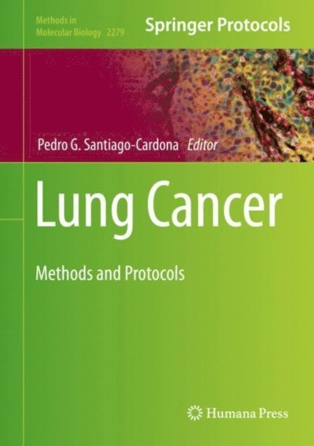 Pedro G. Santiago-Cardona - Lung Cancer, E-bok