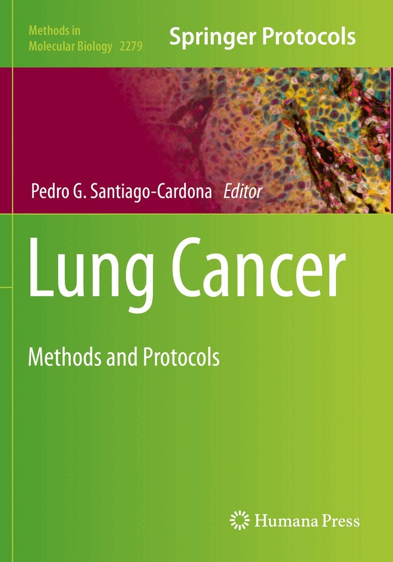 Pedro G. Santiago-Cardona - Lung Cancer, Häftad