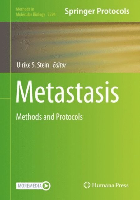 Ulrike S. Stein - Metastasis, E-bok