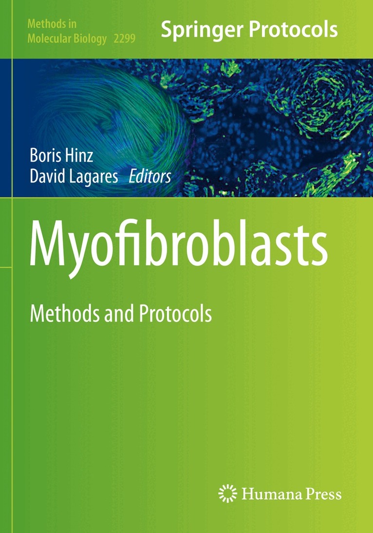 Boris Hinz, David Lagares - Myofibroblasts, Häftad. Tillgänglighet: Lägg i varukorg