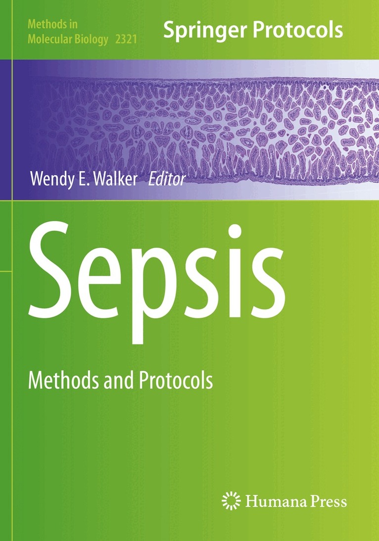 Wendy E. Walker - Sepsis, Häftad