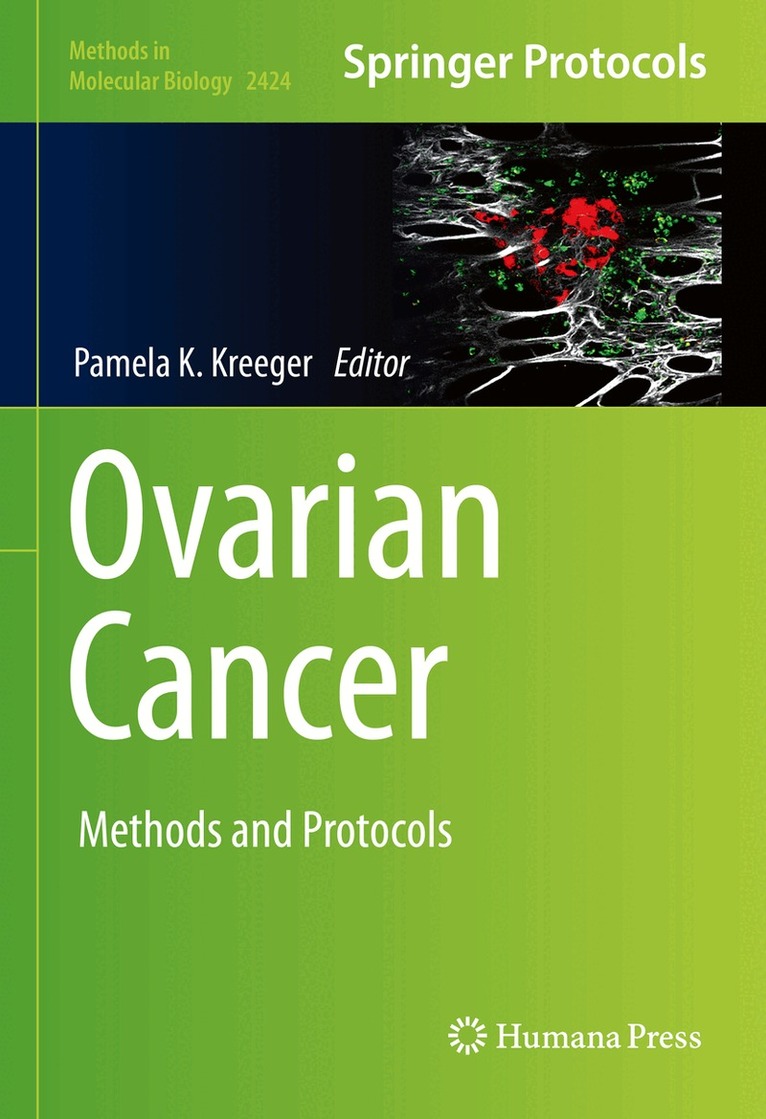 Pamela K. Kreeger - Ovarian Cancer, Inbunden