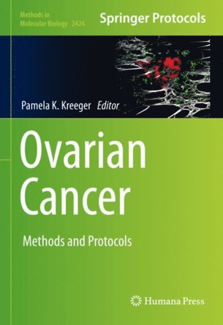 Pamela K. Kreeger - Ovarian Cancer, E-bok