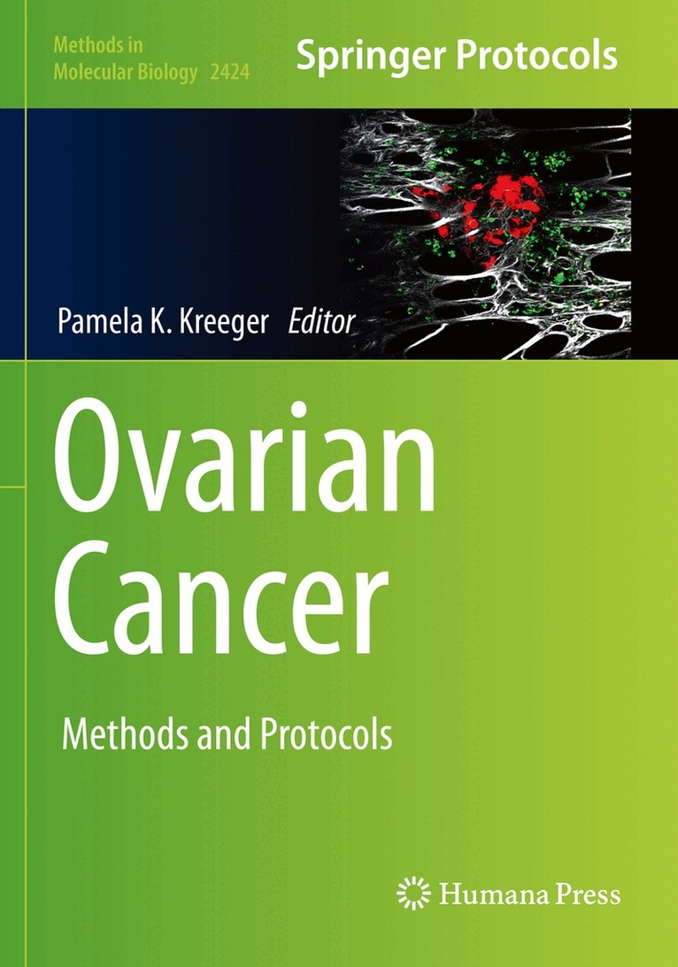 Pamela K. Kreeger - Ovarian Cancer, Häftad
