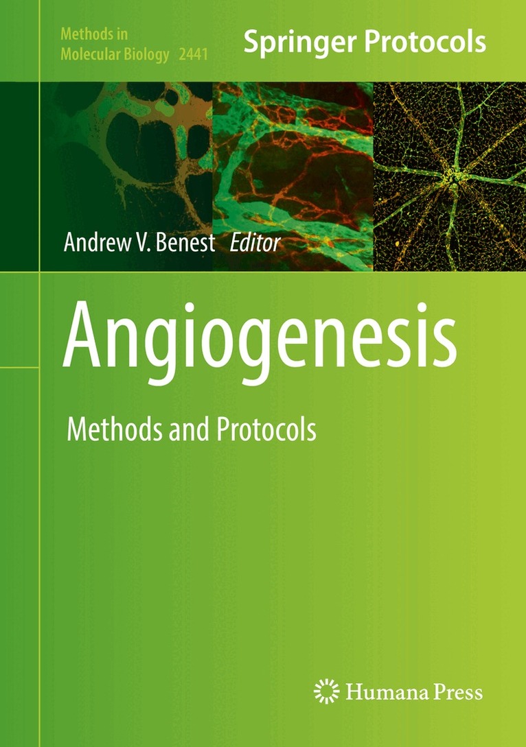 Andrew V. Benest - Angiogenesis, Inbunden