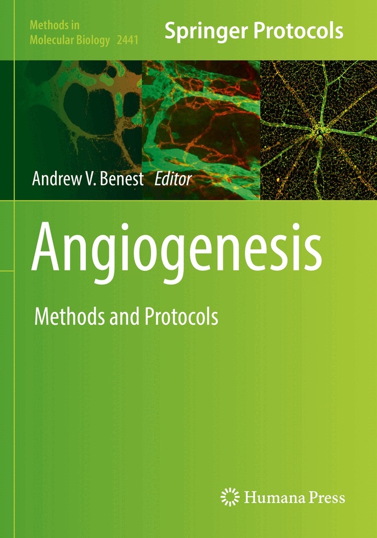 Andrew V. Benest - Angiogenesis, Häftad