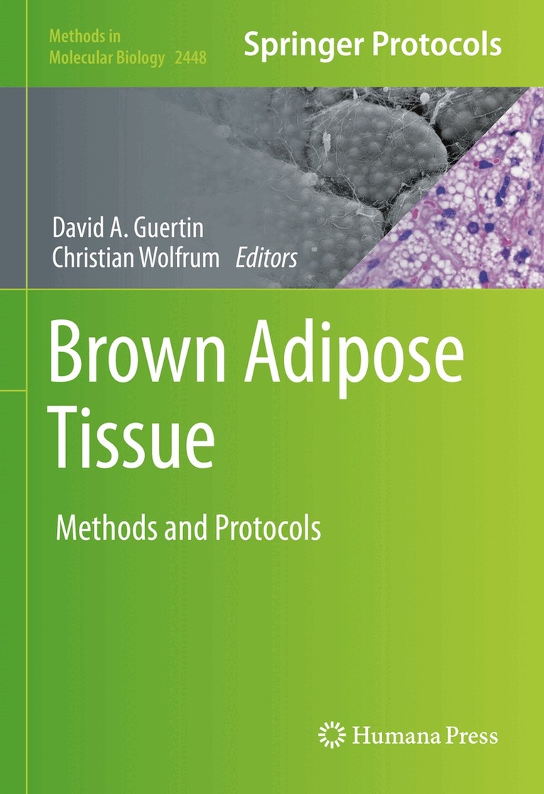 David A. Guertin, Christian Wolfrum - Brown Adipose Tissue, Inbunden