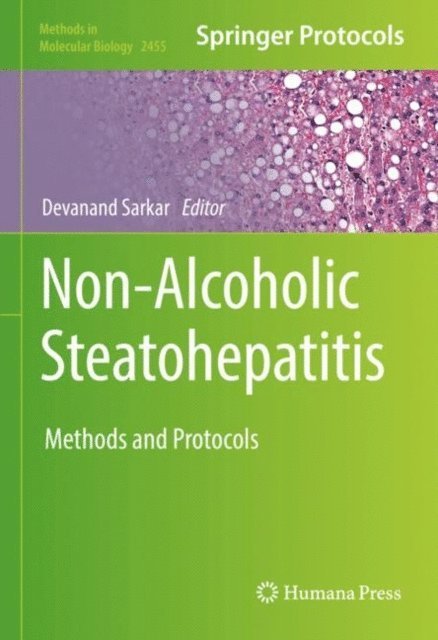Devanand Sarkar - Non-Alcoholic Steatohepatitis, E-bok