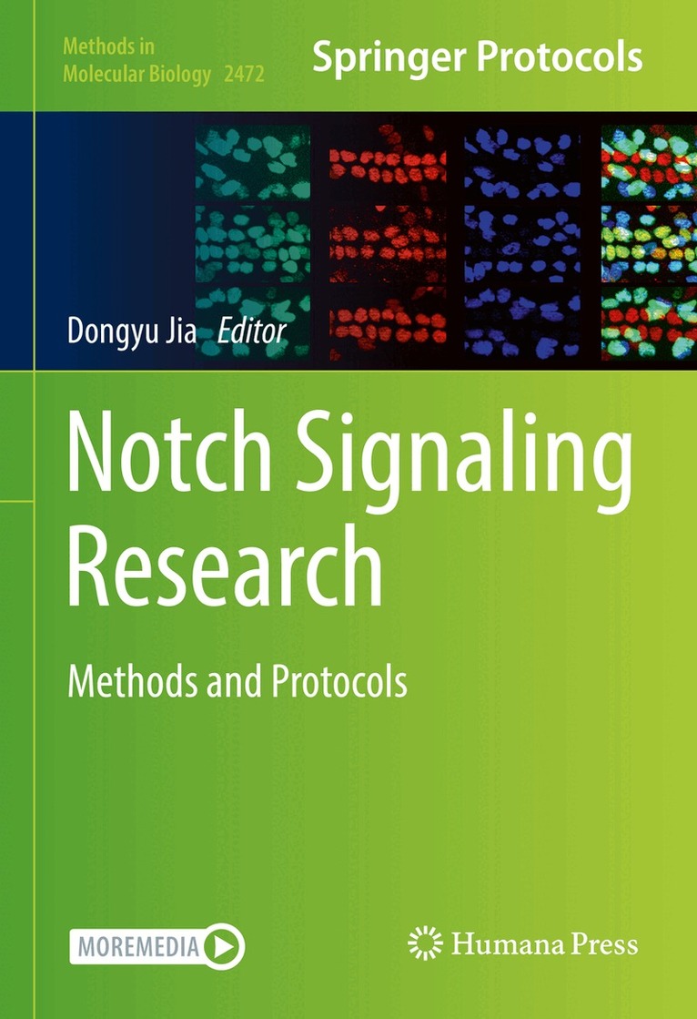 Dongyu Jia - Notch Signaling Research, Inbunden