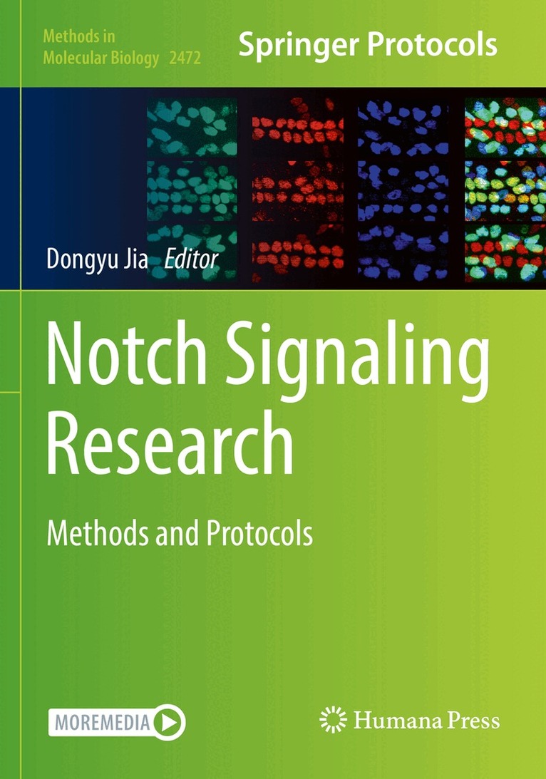 Dongyu Jia - Notch Signaling Research, Häftad