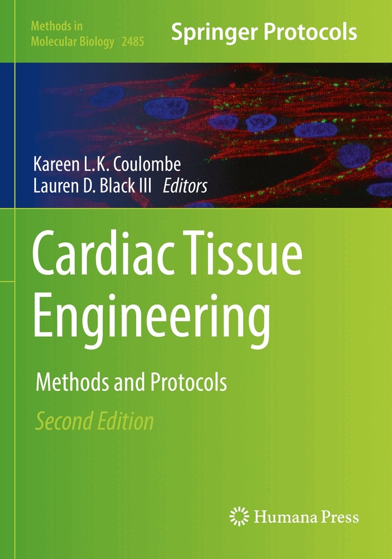 Kareen L.K. Coulombe, Lauren D. Black III - Cardiac Tissue Engineering, Häftad. Tillgänglighet: Lägg i varukorg