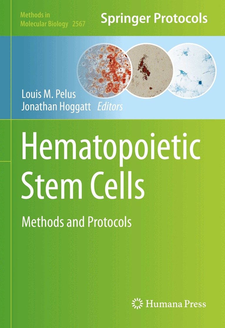 Louis M. Pelus, Jonathan Hoggatt - Hematopoietic Stem Cells, Inbunden. Tillgänglighet: Lägg i varukorg
