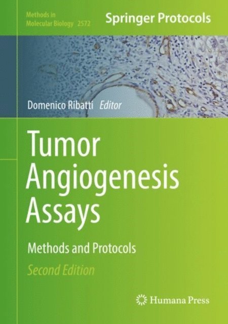 Domenico Ribatti - Tumor Angiogenesis Assays, E-bok