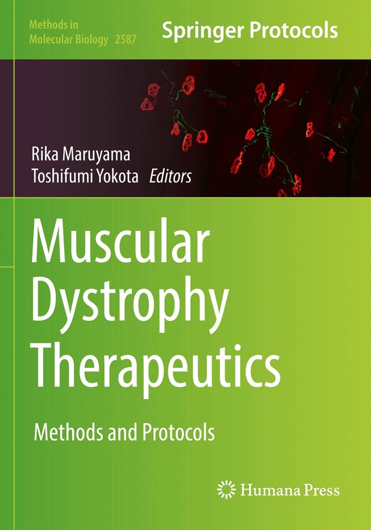 Rika Maruyama, Toshifumi Yokota - Muscular Dystrophy Therapeutics, Häftad