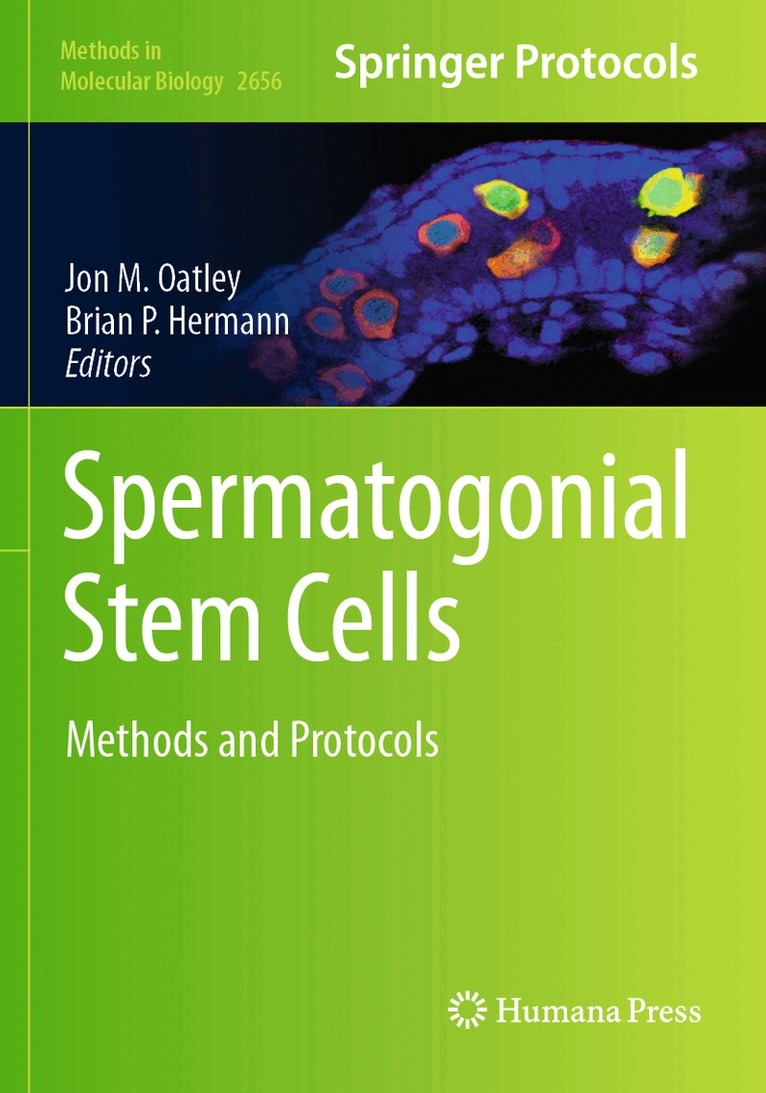 Jon M. Oatley, Brian P. Hermann - Spermatogonial Stem Cells, Häftad. Tillgänglighet: Lägg i varukorg