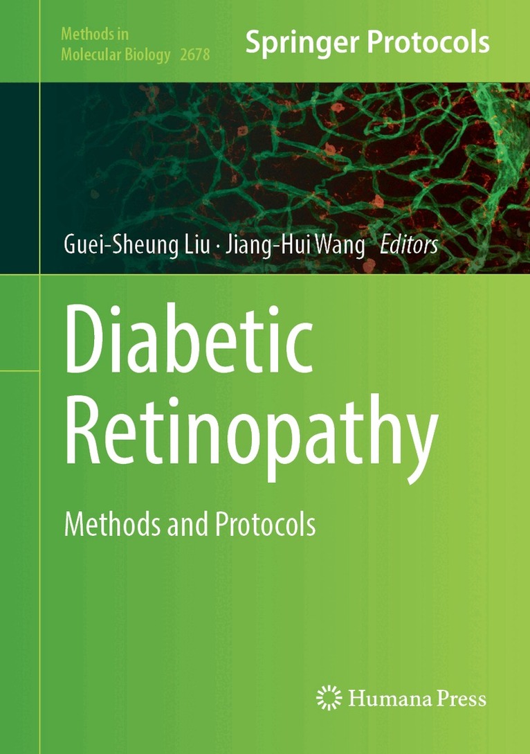 Guei-Sheung Liu, Jiang-Hui Wang - Diabetic Retinopathy, Inbunden. Tillgänglighet: Lägg i varukorg