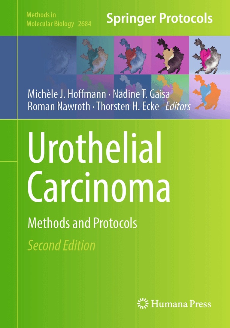 Michèle J. Hoffmann, Nadine T. Gaisa, Roman Nawroth, Thorsten H. Ecke - Urothelial Carcinoma, Inbunden