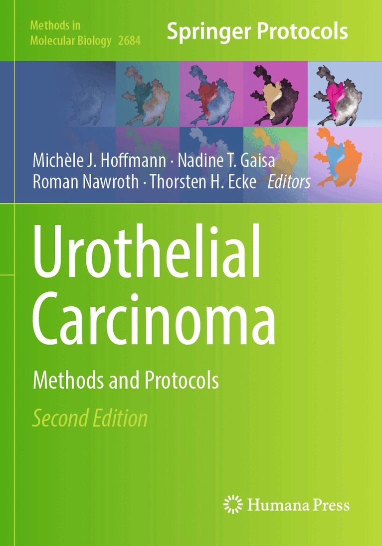 Michèle J. Hoffmann, Nadine T. Gaisa, Roman Nawroth, Thorsten H. Ecke - Urothelial Carcinoma, Häftad