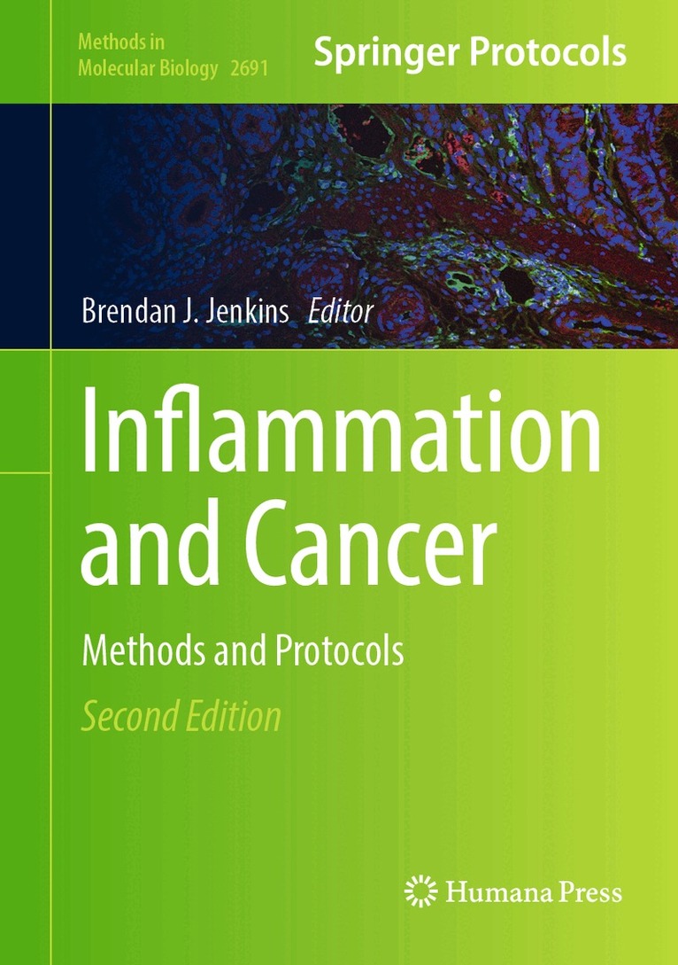 Brendan J. Jenkins - Inflammation and Cancer, Inbunden