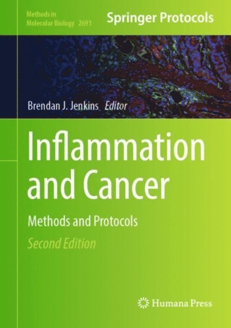 Brendan J. Jenkins - Inflammation and Cancer, E-bok
